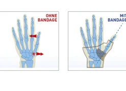 EPITACT "" Daumenbandage